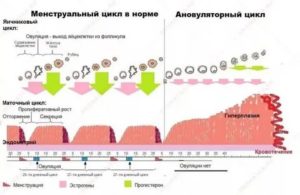 Какими должны быть месячные при ановуляторном цикле