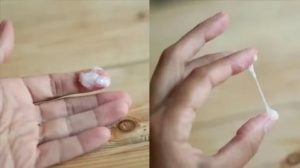 Выделения яичный белок и молочница