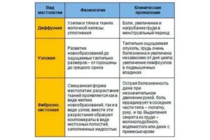 Можно ли ставить мирену при фиброзно кистозной мастопатии