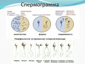 Какие таблетки убивают сперматозоиды