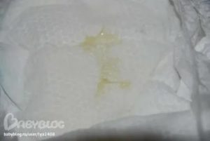 Может ли быть молочница у годовалой девочки