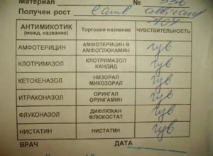 Молочница как определить по анализу мазка