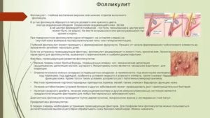 Молочница при сахарном диабете у женщин симптомы лечение