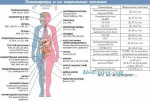 Опухоль яичка онкомаркеры в норме может ли быть рак