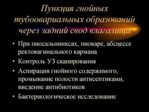 Диагностика не гнойного тубоовариального образования