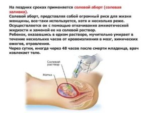 Могут ли начаться месячные во время полового акта