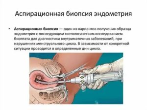 Гистероскопия биопсия эндометрия с гистологическим исследованием