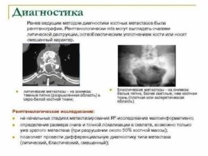 Метастазы в кости при раке молочной железы диагностика