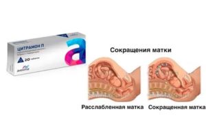 Какие препараты снимают тонус матки в домашних условиях