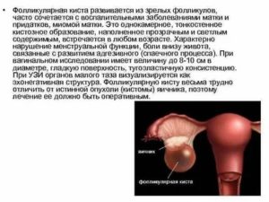 Чем отличается киста яичника от кистомы яичника