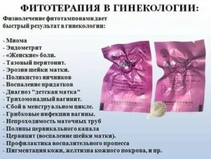 Лечение эндометриоза голубой глиной отзывы