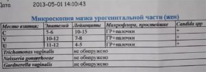 Молочница как определить по анализу мазка