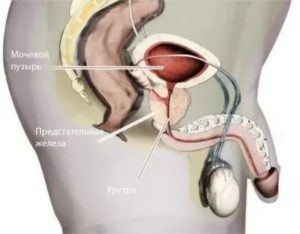 Что такое дренирование предстательной железы