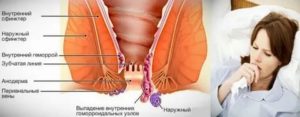 Климакс женщины зуд заднего прохода