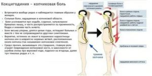 Боли в области копчика при эндометриозе