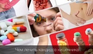 Кандидоз кишечника вылечить чесноком