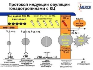 Узи контроль при стимуляции овуляции