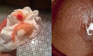 Что означает когда месячные не начинаются а мажут