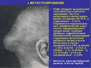 Продолжительность жизни при метастазах в костях при раке молочной железы