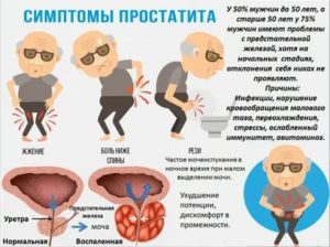 Что будет если в 18 лет заболеть простатитом