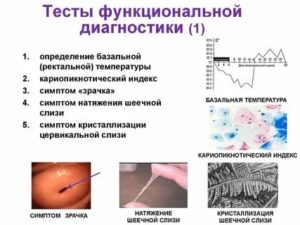 Тесты диагностики функционального состояния яичников