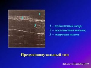 Узи молочных желез показало преимущественно жировая железистая ткань