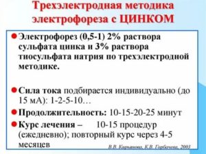 Электрофорез с йодом и цинком при эндометриозе