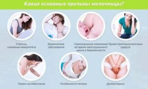 Может ли пиелонефрит вызвать молочницу
