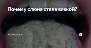 Выделение слюны при кандидозе