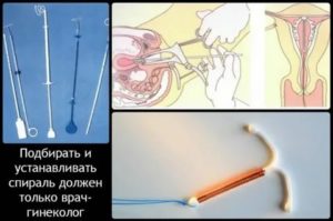 Могут ли месячные начаться на 10 дней раньше из за установки спирали