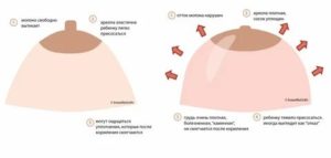 Может ли перед месячными одна грудь быть больше другой