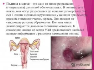 Может ли эндометриоз быть причиной выпадения волос