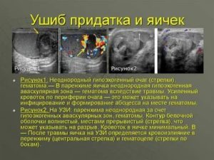 Препарата при ушибе мошонки