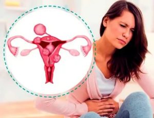 Может ли при эндометриозе болеть поясница и низ живота что это может быть