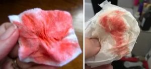 Что может быть если идет вместо месячных кровотечение