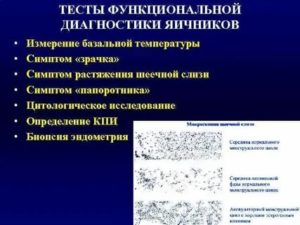 Что такое функциональная диагностика в гинекологии