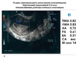 Фото матки по дням цикла фото