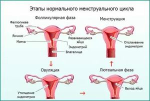 Когда могут начаться месячные при эндометрии 13