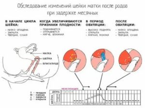 Когда должны быть месячные после рдв