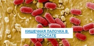 Эшерихия коли в простате лечение