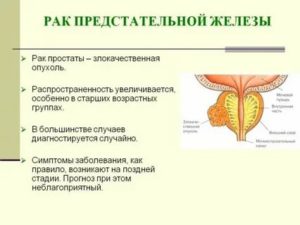 Галлюцинации при раке простаты