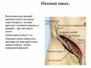 Паховые связки разрыв узи