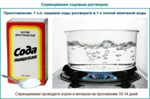 Рецепт от молочницы с содой с солью и йодом спринцевание