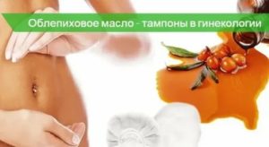 Облепиховое масло при молочнице во время беременности
