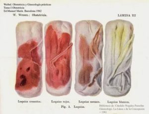 Какого цвета должны быть месячные после кесарево