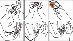 Как правильно пользоваться менструальной чашей