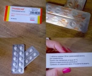 Маточное кровотечение от дюфастона что делать