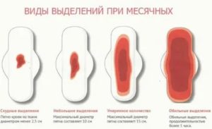 Могут у девочки подростка быть коричневые месячные