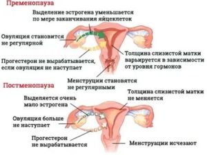 Как отличить беременность от наступления менопаузы