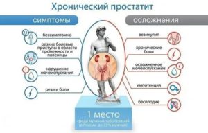 Хронический простатиты википедия